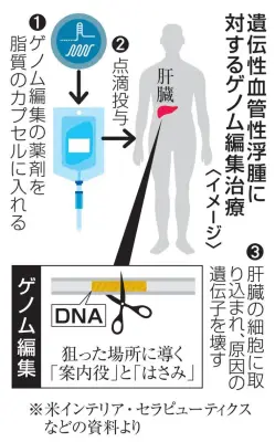 体内ゲノム編集治療の効果確認、初の実用化へ米承認申請開始