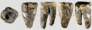 ネアンデルタール人が5万9千年前に石器で虫歯治療、最古の事例か