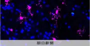 傷ついた脳の回復を持続させる仕組みを解明、脳梗塞治療に期待
