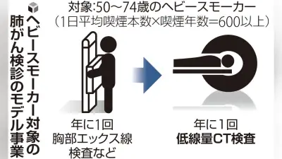 AI技術で肺がん検診の精度向上、早期発見に期待 東大病院が実証実験
