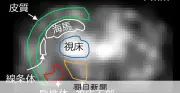 生きたマウスの脳を0.5ミリまで見えるPET装置、QSTが開発
