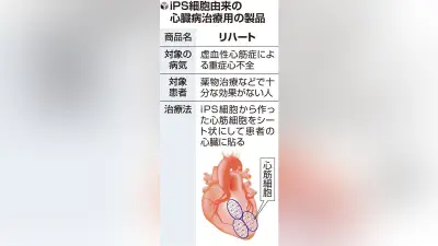 iPS由来心臓病治療シート「リハート」、9月から保険適用へ 2例目