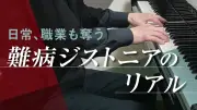 難病ジストニアの実態：医師すら知らない恐怖と診療の壁