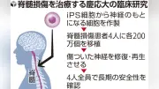 iPS細胞移植、脊髄損傷患者で最長4年観察 腫瘍なし