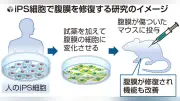 iPS細胞から腹膜細胞作製成功、人工透析の再生医療に道