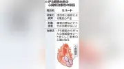 iPS由来心臓病治療シート「リハート」、9月から保険適用へ 2例目