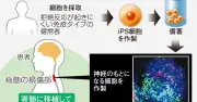 慶応大iPS神経細胞移植、最長4年追跡で長期安全性確認　来年度中にも治験申請へ