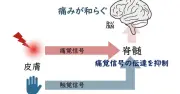 痛いところをさすると痛みが引く仕組み、九州大学が解明