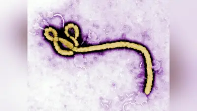 エボラ不活化ワクチン、人での治験で安全性と有効性を初確認