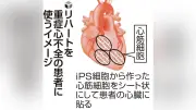 ｉＰＳ細胞治療、２製品を条件付き承認　今秋にも使用開始へ