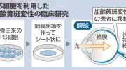 iPS細胞20年、高橋政代氏「承認はゴールではない」 世界初の移植から標準治療への道
