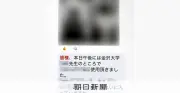 医療機器会社、患者のX線画像を不適切に入手か 9病院で流出疑い