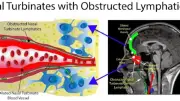 メタボが脳の老廃物排出を阻害、嗅覚障害経て認知症に 米研究チームが新仮説