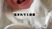 生まれた翌日の“オンギャー”に2.8万いいね、アルビノの娘を発信する母の思い「可哀想ではありません」
