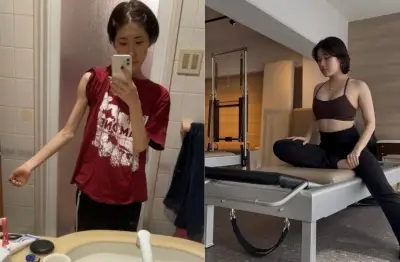 拒食症で33kgから57kgへ…HIYORIさんがビフォーアフター公開した理由「ダイエットのデメリット伝わらない」