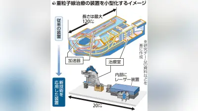 重粒子線装置の小型化に道筋、レーザー新技術で整備費10分の1へ 量研機構