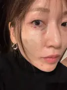 『あいのり』桃、自身のダウンタイム歴を赤裸々公開 母の顔の変色も明かす